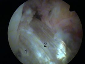 acl-2p$C4$99czki-250.jpg